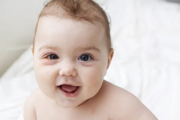 Seorang bayi kecil dengan mata yang memburuk menderita konjungtivitis — Stok Foto