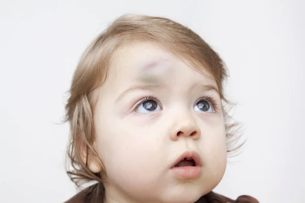 Baby Bruises Images Libres De Droit Photos De Baby Bruises Depositphotos Baby Bruises Images Libres De Droit Photos De Baby Bruises Depositphotos