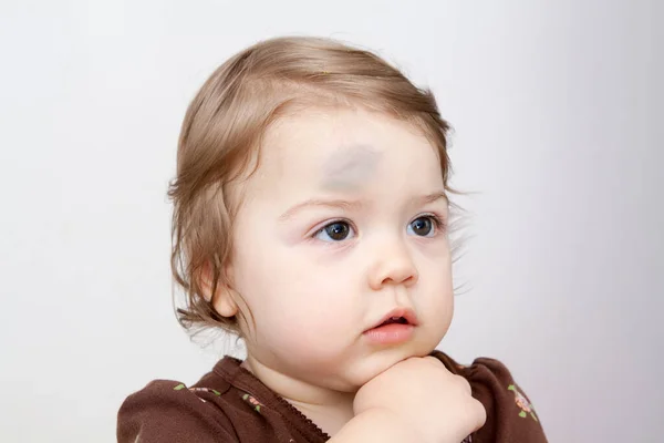 Baby Bruises Images Libres De Droit Photos De Baby Bruises Depositphotos Baby Bruises Images Libres De Droit Photos De Baby Bruises Depositphotos