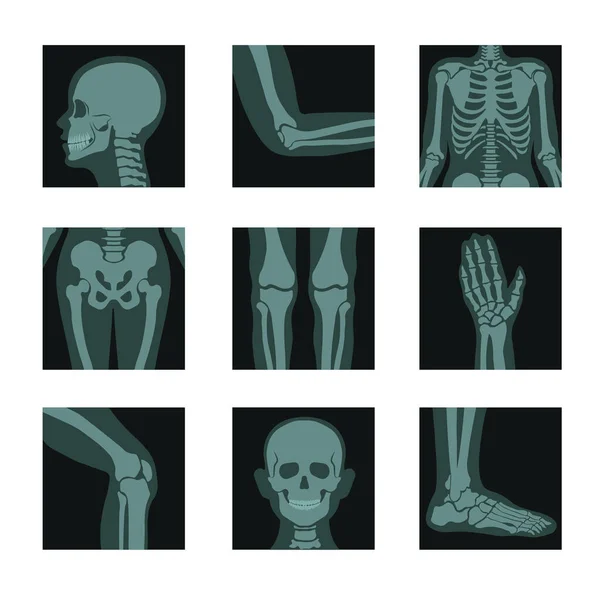 Рентгеновские Снимки Человеческого Тела Снимки Головы Рук Вектора Частей Ног — стоковый вектор