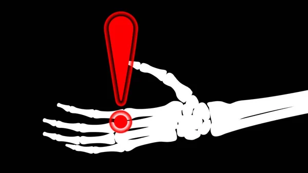 Ikona Uwagi Dłoni Szkieletowej Ilustracja — Zdjęcie stockowe