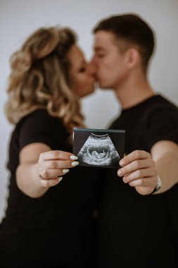 Aşık çift ultrason hamileliği