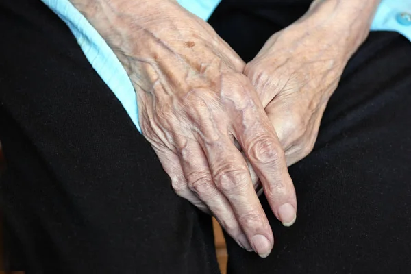 노인 백인 여자 손 — 스톡 사진