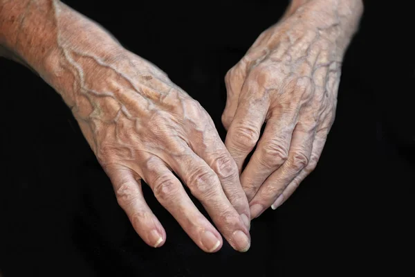 노인 백인 여자 손 — 스톡 사진