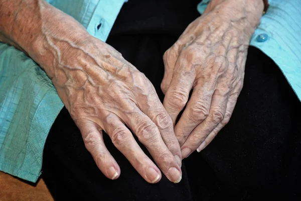 Τα χέρια τους ηλικιωμένους καυκάσιες γυναίκες — Φωτογραφία Αρχείου