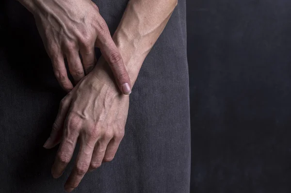 Mãos femininas com veias sanguíneas. Gesto emocional . — Fotografia de Stock