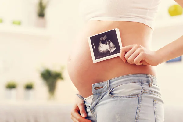 Těhotná žena drží ultrazvukem — Stock fotografie