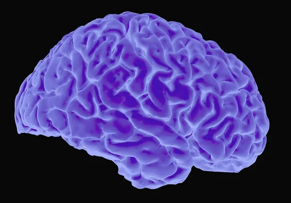 Human brain xray — Stock Photo, Image