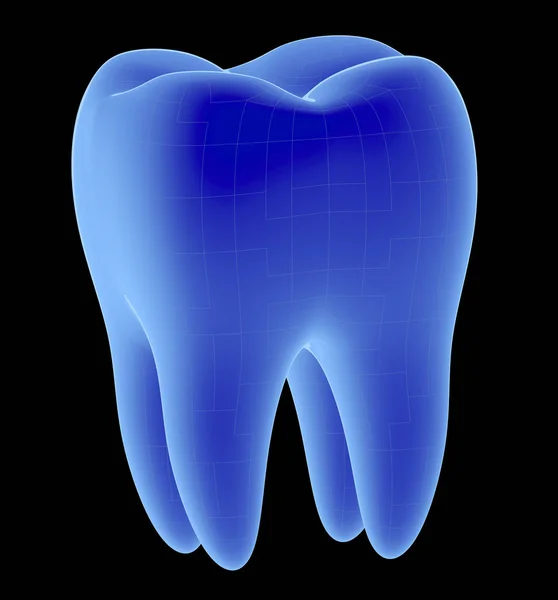 Рентгенівська зуба концепції — стокове фото