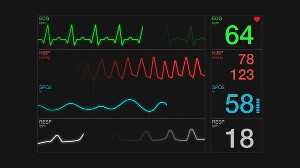 Ecg ekran — Stok fotoğraf