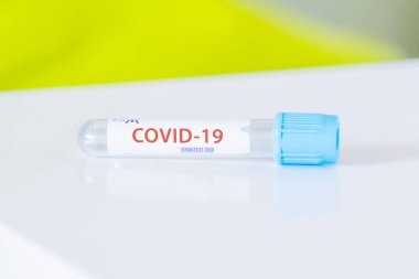 Corona virüsü için Covid-19 test tüpü parlak bir ortamda klinik beyaz bir masada.