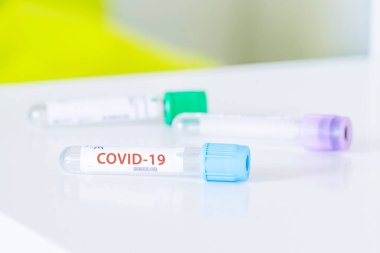 Corona 'nın tedavisini bulmak için Covid-19 virüsü ve aşı örnekleri için test tüpü..