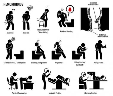 Hemoroit ve ikon yığınları. Piktogram ve diyagramlarda ürolog ve doktor tarafından hemoroit ve hemoroit ve kümelerin işaretleri, semptomları, teşhisi, muayenesi ve tedavisi yer alıyor..