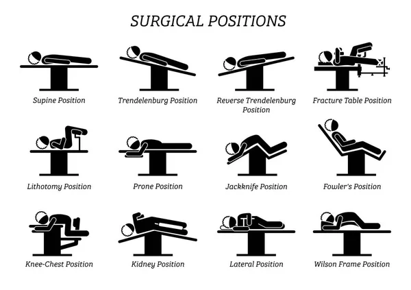 Surgical Surgery Operation Positions. Stick figures depict a set of surgery positions for the patient on the surgery chair and bed. — Stock Illustration Surgical Surgery Operation Positions Stick Figures Depict Set Surgery Positions Stock Illustration