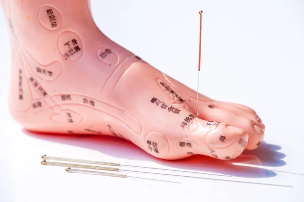 Akupunktura demonstrace na nohy model — Stock fotografie
