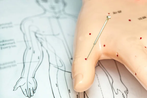 Acupuncture demonstration on hand model — Stock Photo, Image