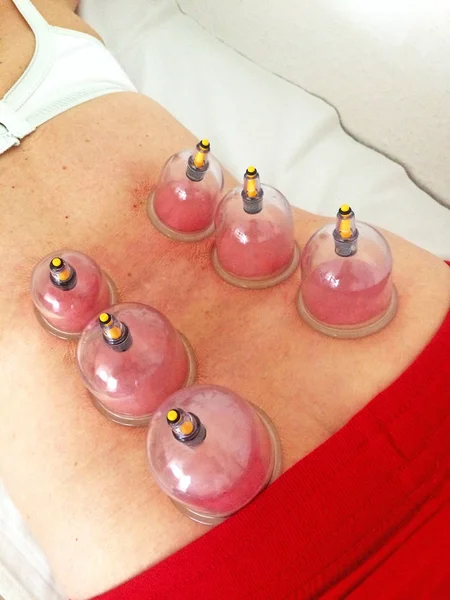 bir kadın geri çukurluğu tedavisi