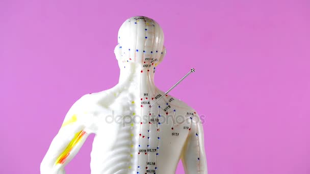 Akupunktur Iğneleri Dönüş Tablosundaki Modeliyle Akupunktur — Stok video