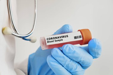 Kavramsal fotoğraf. Coronavirus testi: Bir el, hasta numunesi içeren bir test tüpünü tutar
