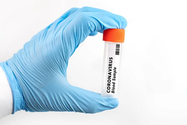 Coronavirus 2019 Ncov血液样本 新发的科罗纳病毒Corona病毒爆发了科罗纳病毒在实验室 带血液检测的科学家固定管 — 图库照片