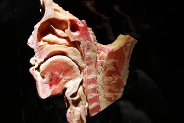  tam olarak plastinated insan vücudu