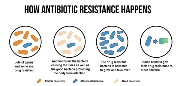 Jak se rezistence k antibiotikům se stane diagramu — Stockový vektor