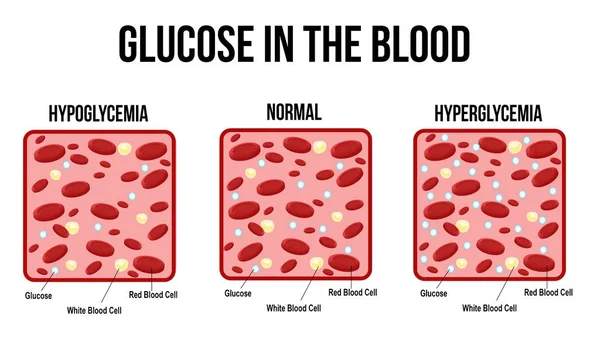 Niveles de glucosa en el diagrama sanguíneo — Vector de stock