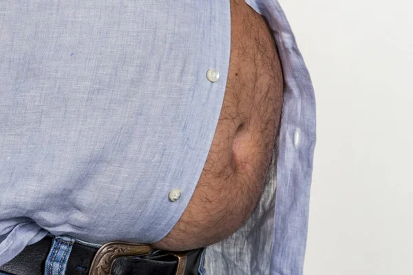 Man with overweight — Stock Photo, Image