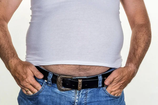 Man with overweight — Stock Photo, Image