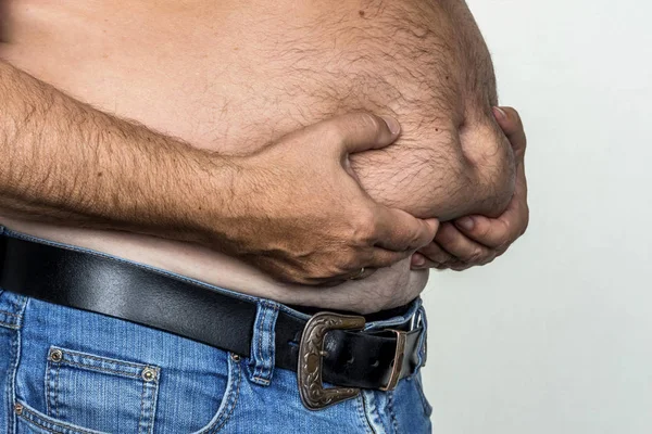 Man med övervikt — Stockfoto