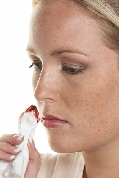 Jonge vrouw heeft bloeden neus — Stockfoto