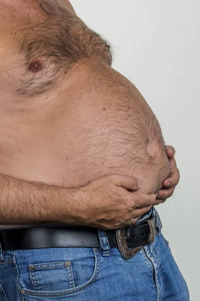 Homem com excesso de peso — Fotografia de Stock