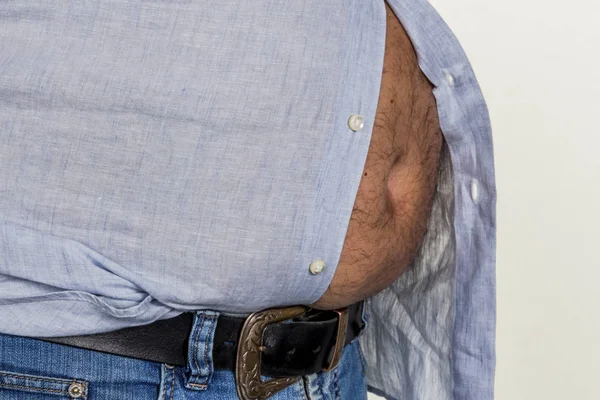 Man with overweight — Stock Photo, Image