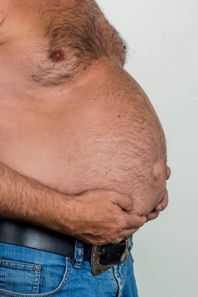 Man with overweight — Stock Photo, Image