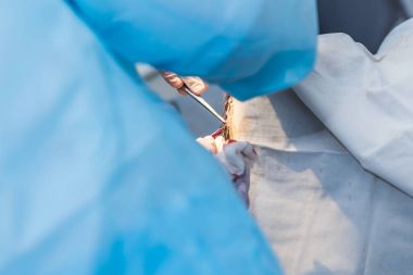cerrahlar doktorlar hastanın ameliyatı eller