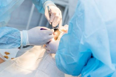cerrahlar doktorlar hastanın ameliyatı eller
