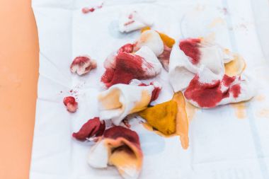 sonra bir yığın yalan kan izleri ile kullanılan gazlı bez tampon 