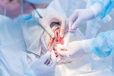 bir cerrahın elleri kesilmiş deri dikiş doktor af