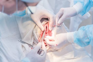 bir cerrahın elleri kesilmiş deri dikiş doktor af