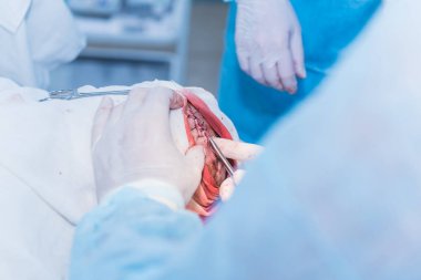 bir cerrahın elleri kesilmiş deri dikiş doktor af