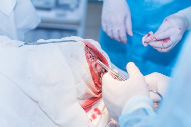 bir cerrahın elleri kesilmiş deri dikiş doktor af