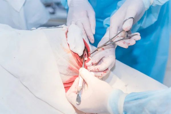 the hands of a surgeon\'s doctor sewing up the cut of the skin af