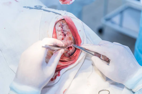 Las manos del médico de un cirujano cosiendo el corte de la piel af —  Fotos de Stock
