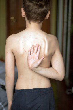 su çiçeği olan çocuk