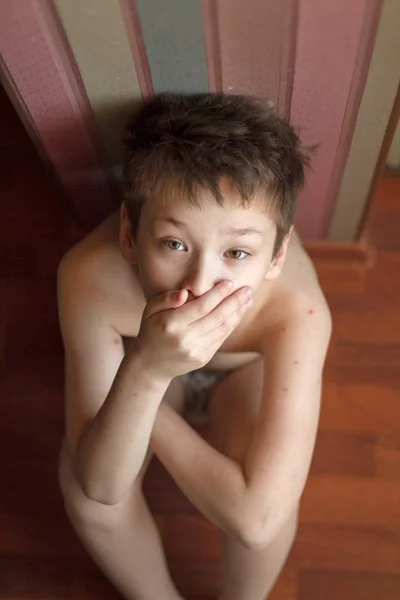 水痘的男孩 — 图库照片