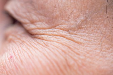 Asyalı Kadın Yüzü Yüzündeki Çiller, Cilt Sorunları