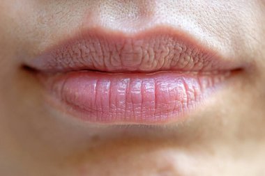 Kadının Yüzünün Dudaklarını Kapat