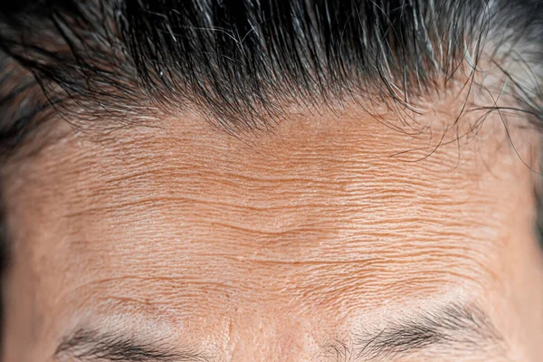アジアの女性の顔 皮膚の問題上のそばかす — ストック写真