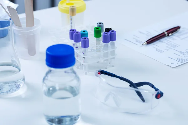 Equipamento de laboratório de análise na mesa — Fotografia de Stock