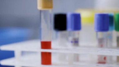 Laboratuvarda pozitif koronavirüs testi yapılmış kan örneği tüpü.